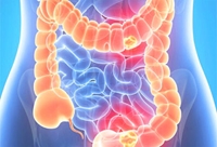 Performing a Successful Surgery Colorectal cancer